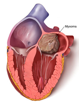cardiac 64 mdct