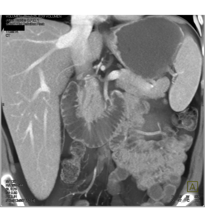 CTisus Contrast Protocols CT Scanning