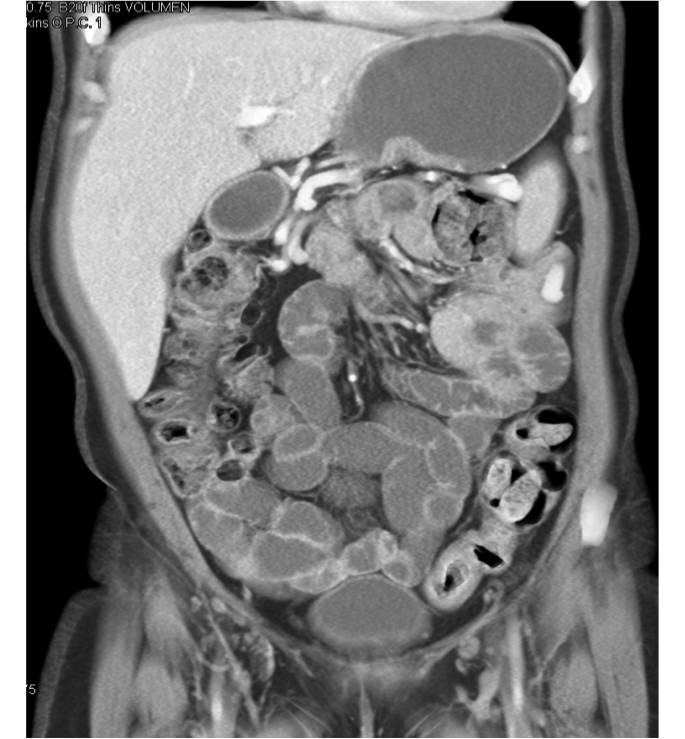 CTisus Contrast Protocols CT Scanning