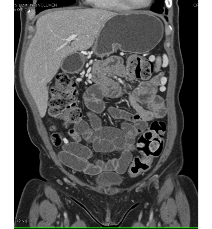 CTisus Contrast Protocols CT Scanning