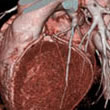 64 Slice MDCT