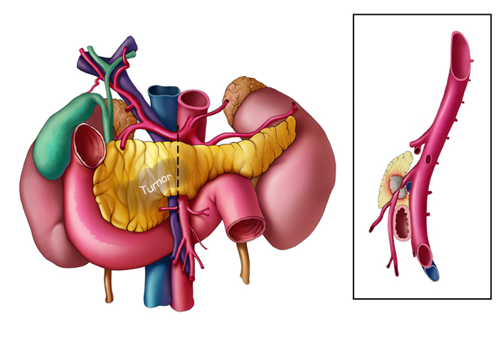 Medical Illustration Gallery - Learning Modules | CT Scanning | CT