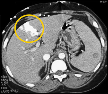 cardiac 64 mdct