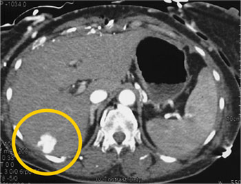 cardiac 64 mdct