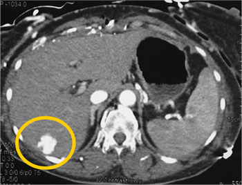 cardiac 64 mdct