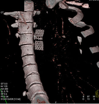 cardiac 64 mdct