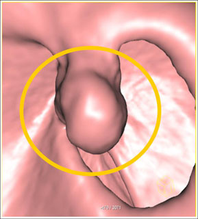 IV contrast image