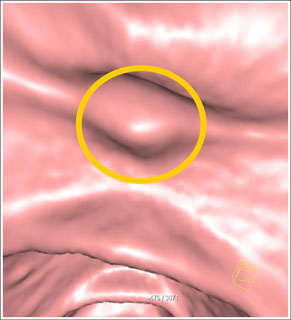 IV contrast image