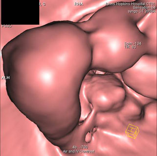 IV contrast image <td align=