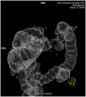 IV contrast image