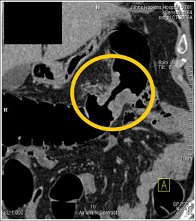 IV contrast image