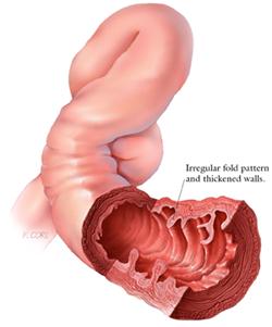 CTisus Medical Illustrations