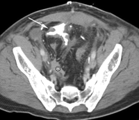   Fig. 5B 