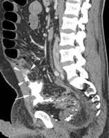  Fig. 5C 