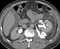   Fig. 8A 