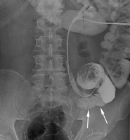   Fig. 9B 
