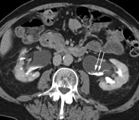   Fig. 11A 