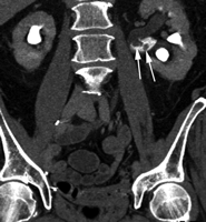   Fig. 11B 