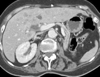   Fig. 12A 