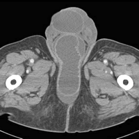   Fig. 15B 