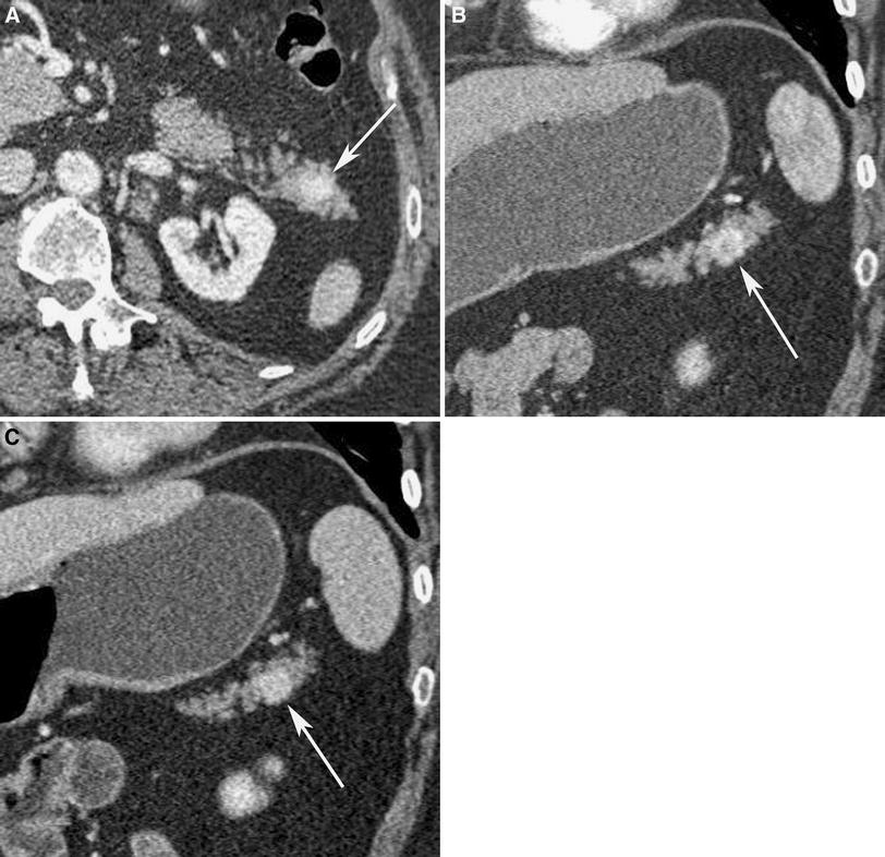 MediaObjects/261_2011_9830_Fig10_HTML.jpg