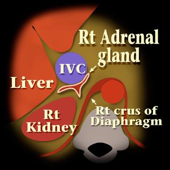 Right adrenal