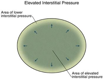 Elevated pressure