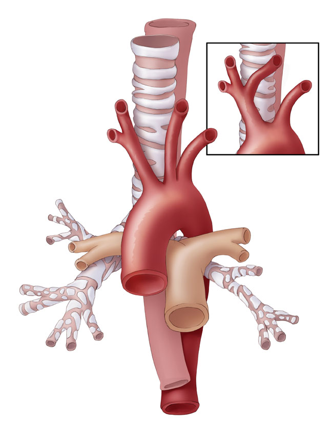 Normal Aortic Arch