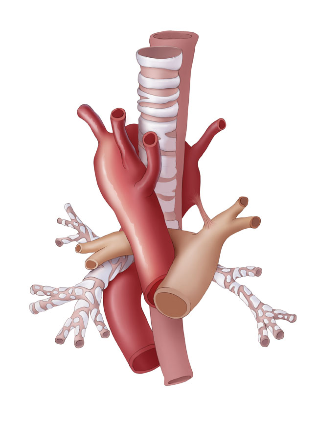 Medical Illustration Gallery - Learning Modules | CT Scanning | CT