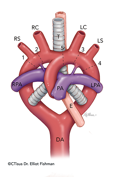 Embryological Heart