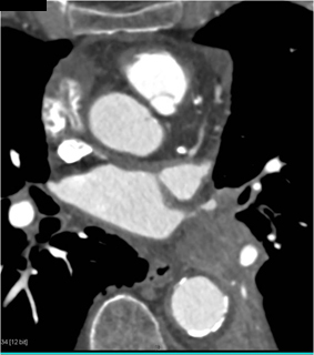 CTisus Quiz