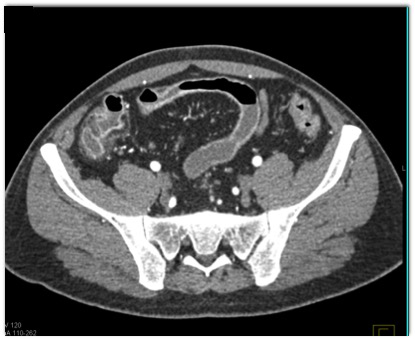 CTisus Quiz