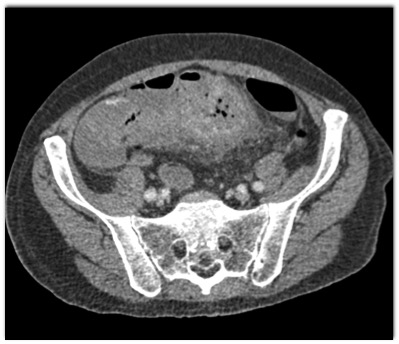 CTisus Quiz