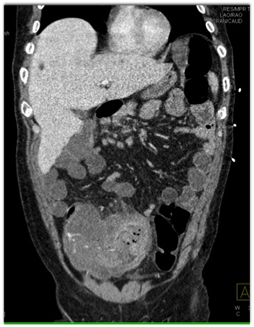 CTisus Quiz