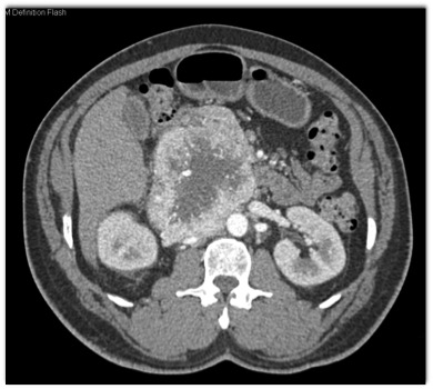 CTisus Quiz