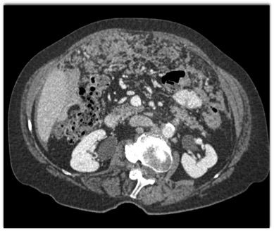 CTisus Quiz