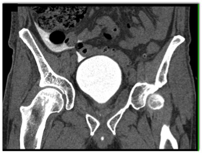 CTisus Quiz