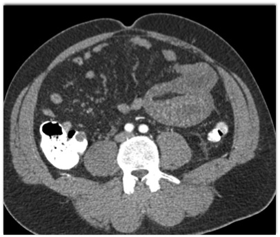 CTisus Quiz