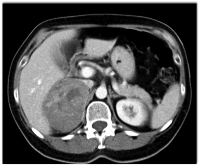 CTisus Quiz