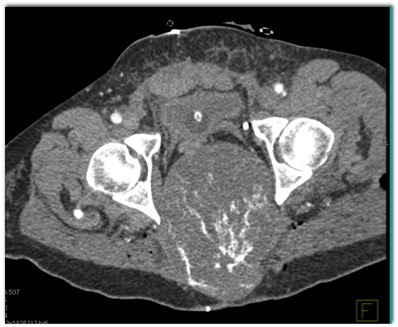 CTisus Quiz