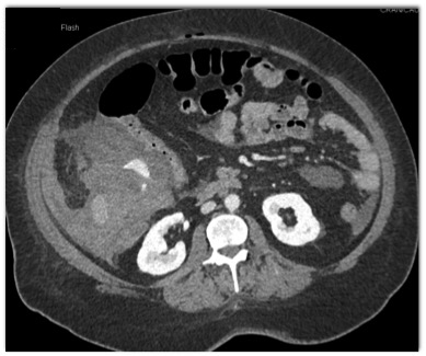 CTisus Quiz
