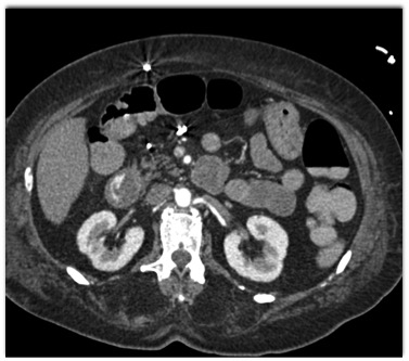 CTisus Quiz