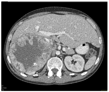 CTisus Quiz