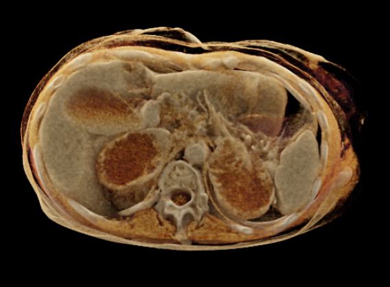 CTisus Quiz