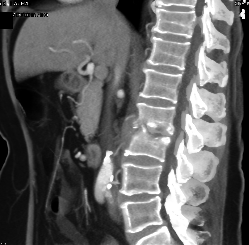 CTisus Quiz
