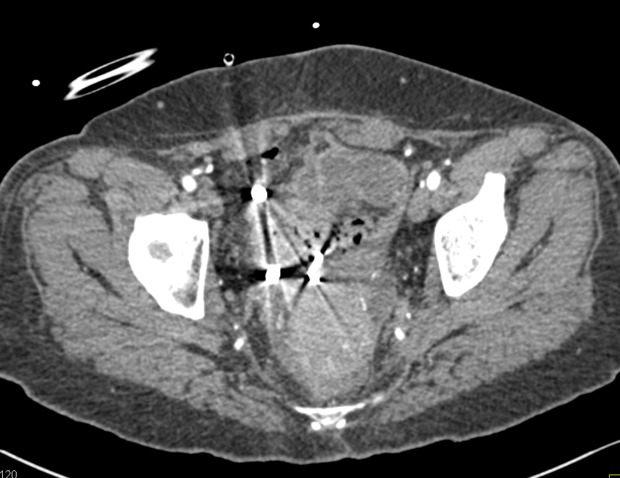 CTisus Quiz