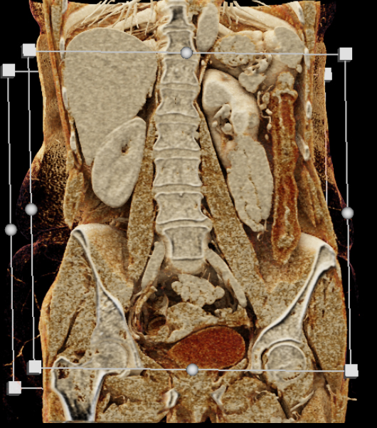 CTisus Quiz