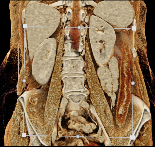 CTisus Quiz