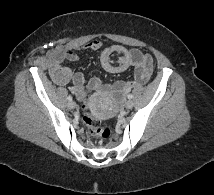 CTisus Quiz