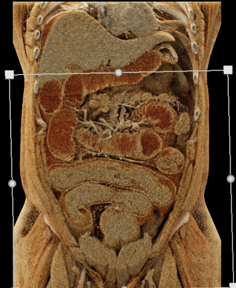 CTisus Quiz